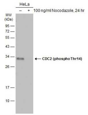 Western Blot: CDC2/CDK1 [p Thr14] Antibody [NBP3-13300]